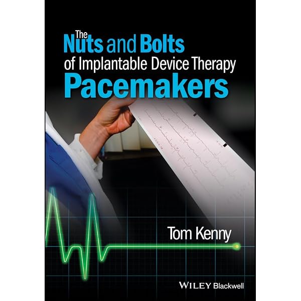 Amazon.com: Simplified Interpretation of Pacemaker ECGs eBook